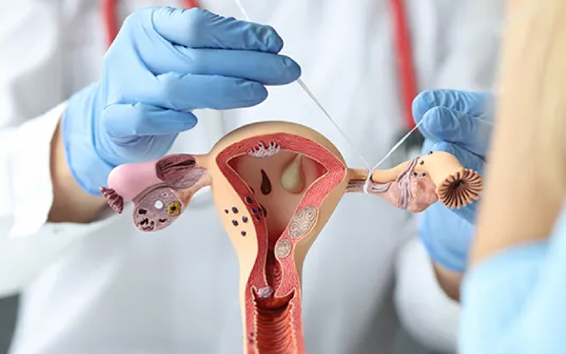 Best Gynecologist in Mumbai