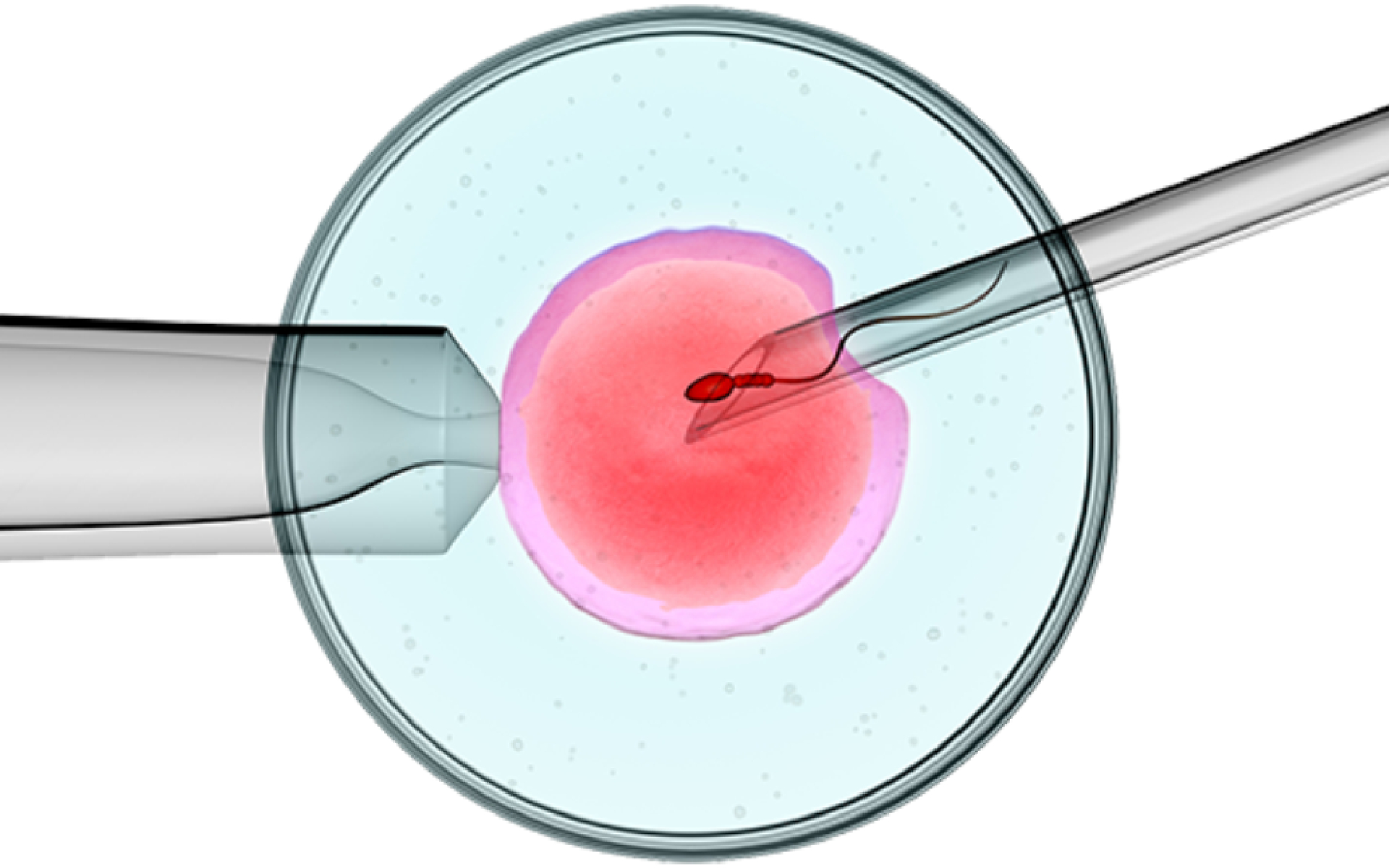IVF Test Tube Baby Treatment in Mumbai
