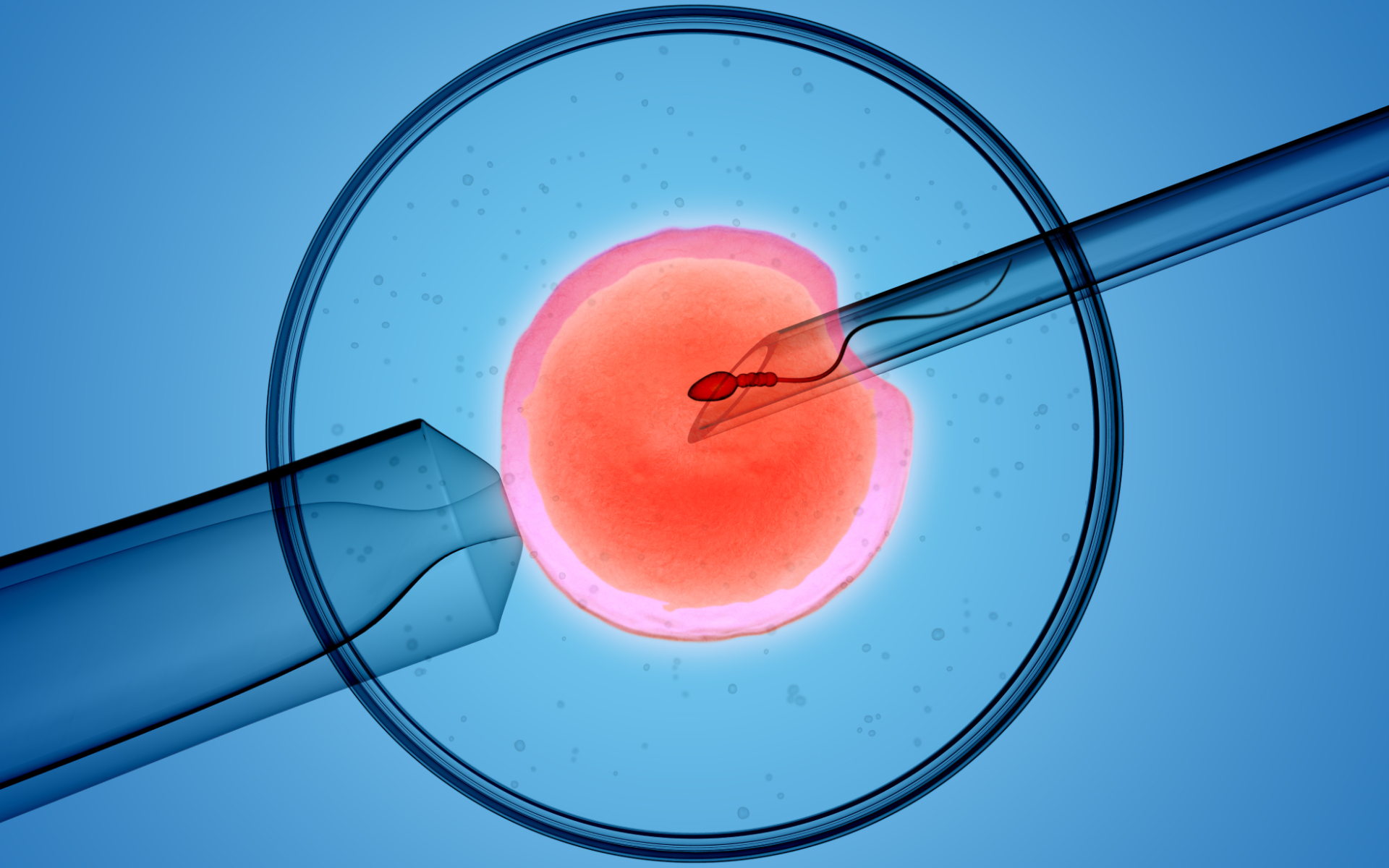 ICSI Treatment in Mumbai