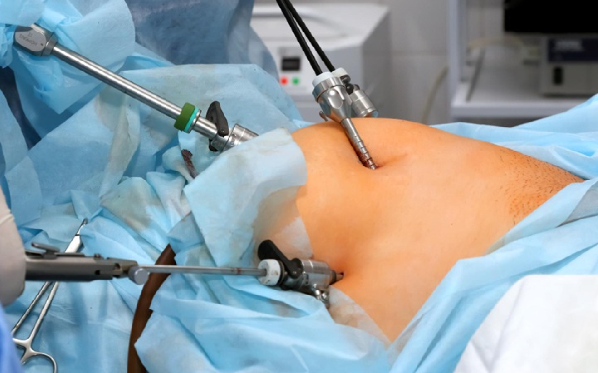 Laparoscopic Surgery in Mumbai