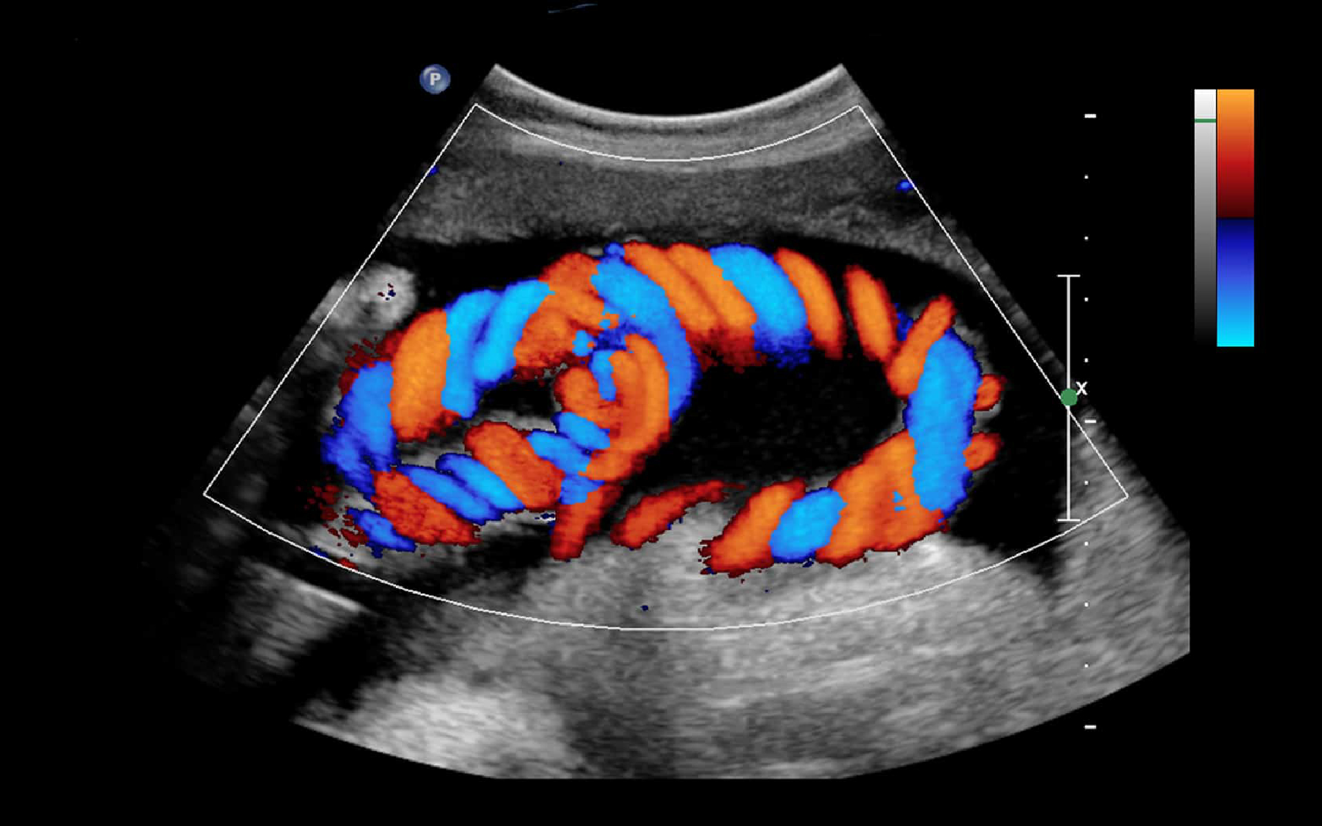 Colour Doppler Scan in Mumbai